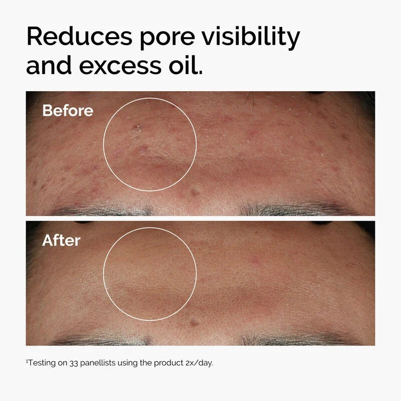 The Ordinary Niacinamide 10% + Zinc Serum – 30ml