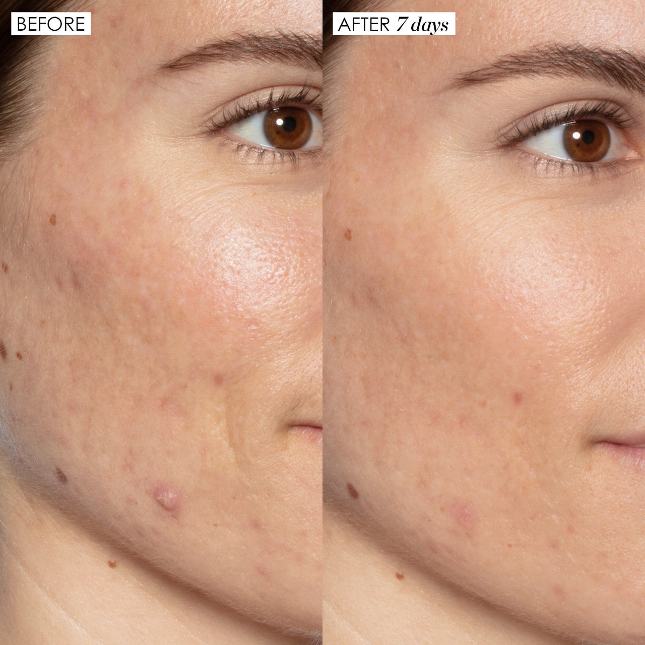 Sunday Riley Good Genes All-In-One Lactic Acid Treatment Serum